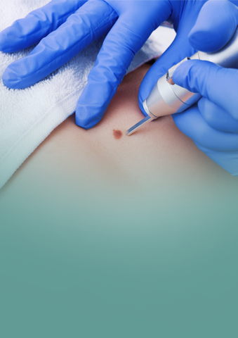 Pequenos Procedimentos Cirúrgicos Ambulatoriais